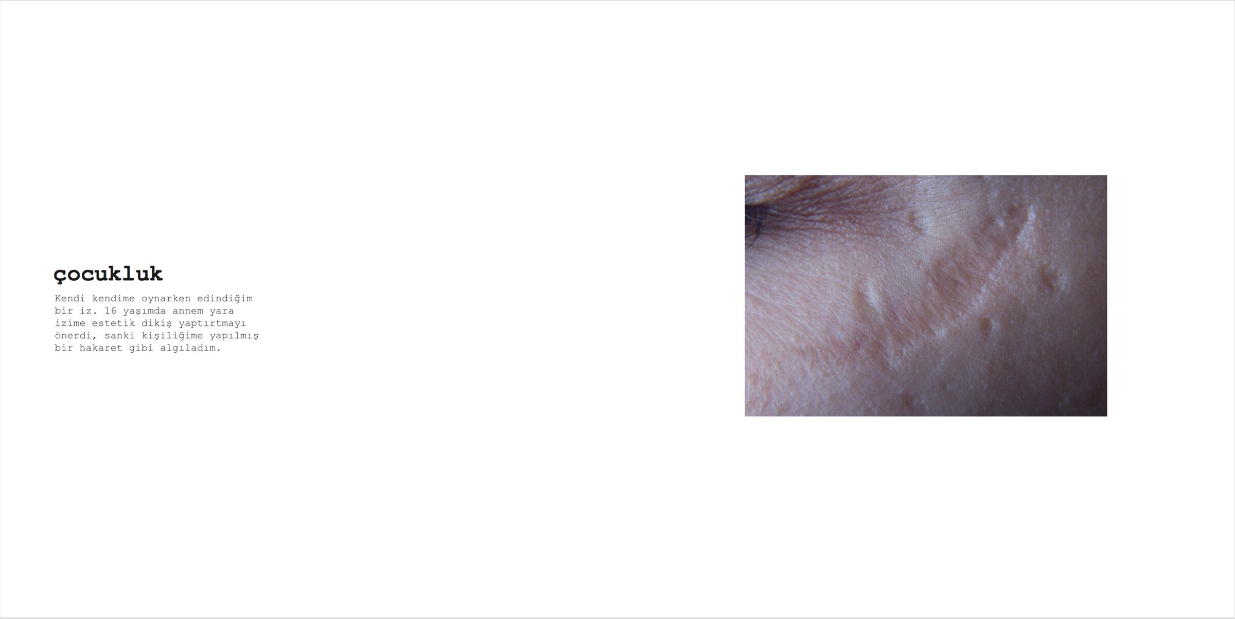 Scar, image 7