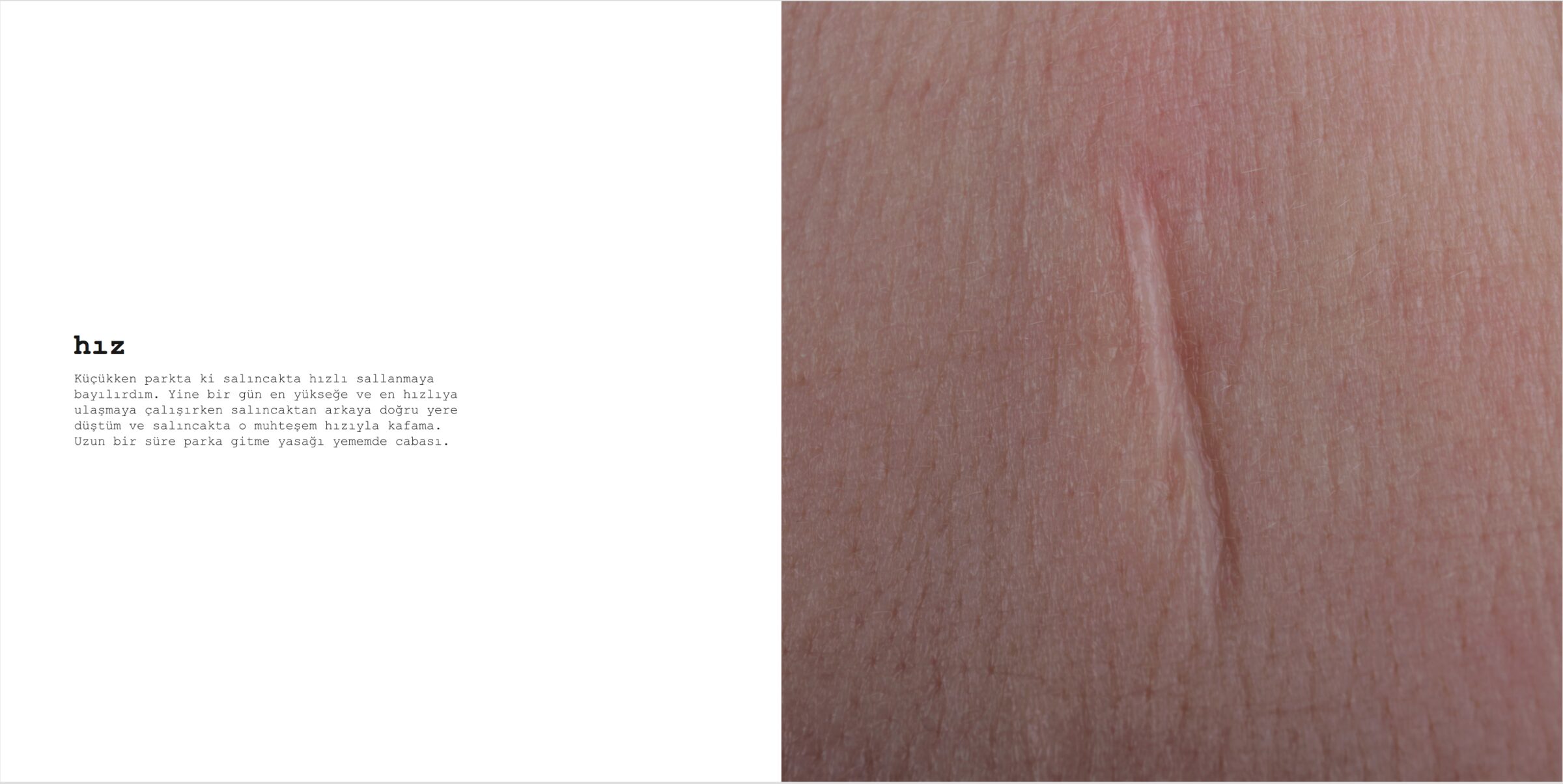 Scar, image 8
